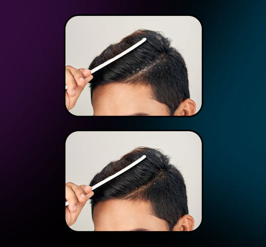 ANTI DANDRUFF SHAMPOO - Tugain Essentials