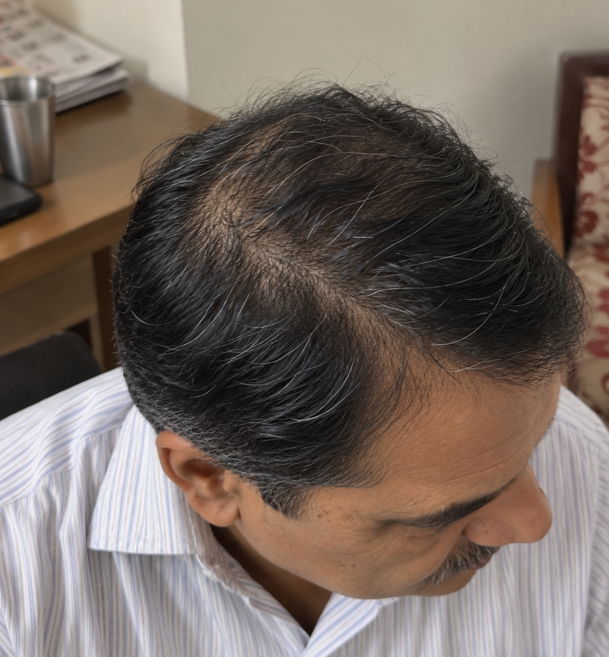 Tugain Anti-Dandruff Shampoo customer review by Bhishmkumar Vadhel