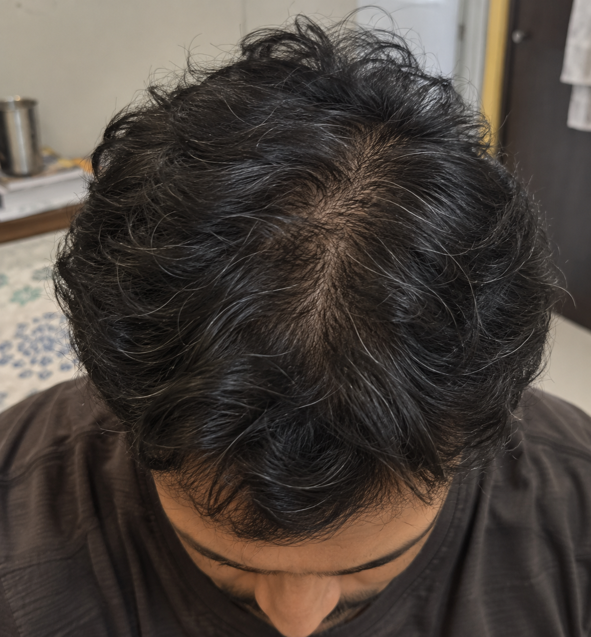 Tugain Anti-Dandruff Shampoo customer review by Uddab Bhattacharya