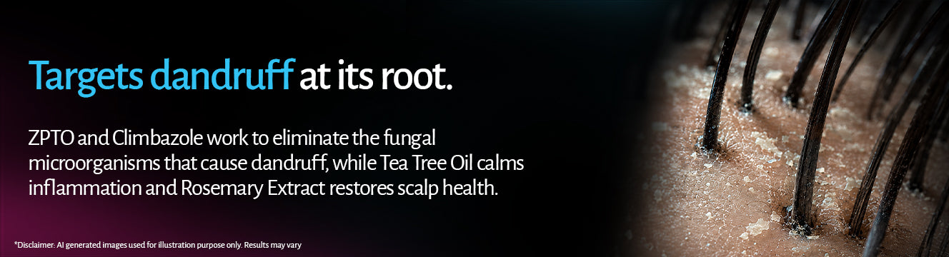 Anti Dandruff Shampoo