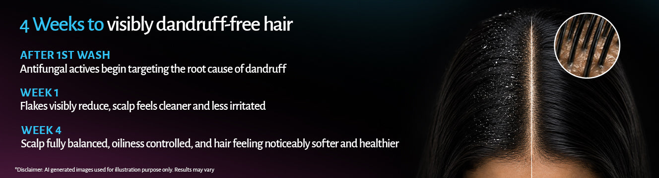 Anti Dandruff Shampoo