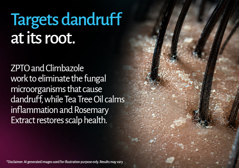Anti Dandruff Shampoo