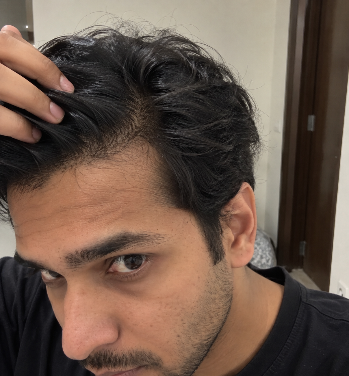 Tugain Hair Growth Serum customer review by Gowtham