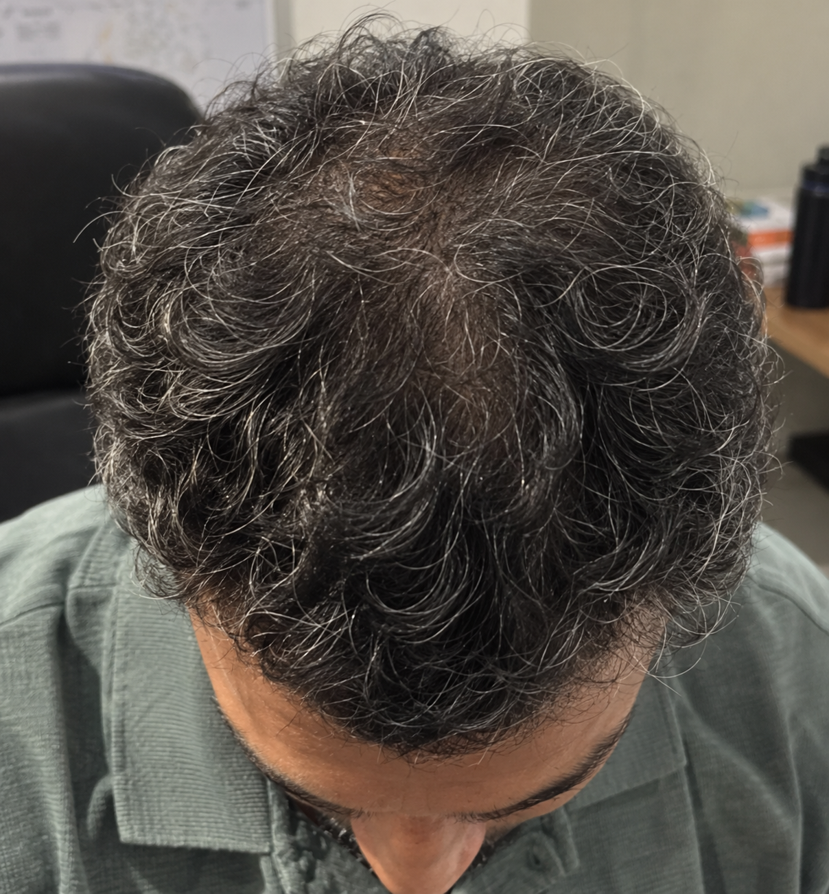 Tugain Hair Growth Serum customer review by Jyothir Ummadi