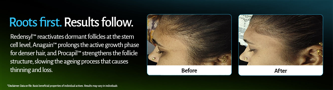 Hair Growth Serum