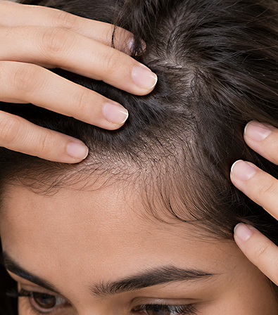 Helps reactivate hair follicles