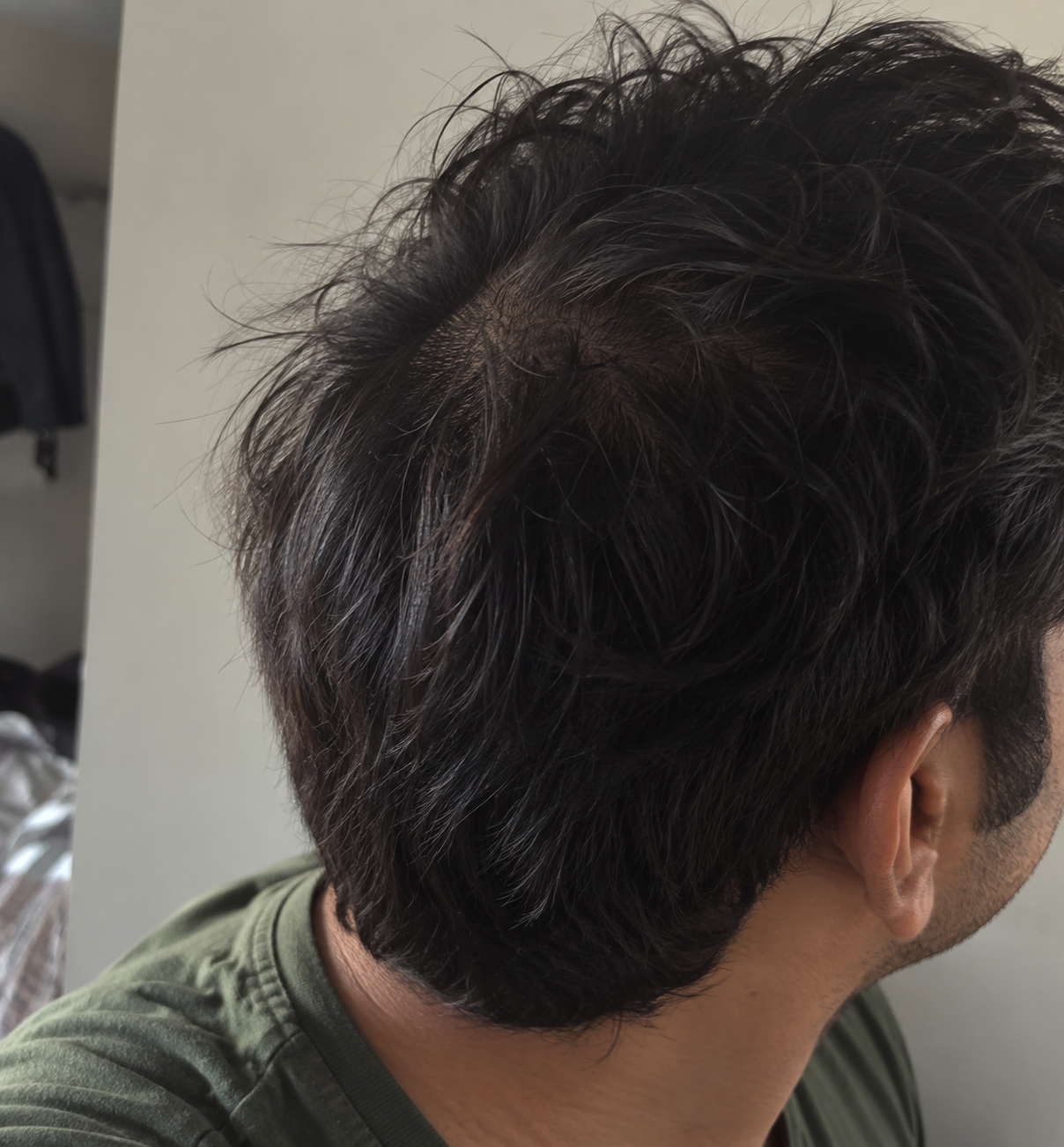 Tugain 2% Ketoconazole Shampoo customer review by an anonymous customer