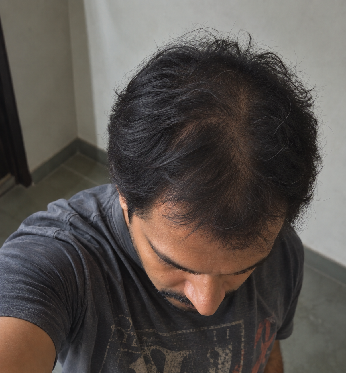 Tugain 2% Ketoconazole Shampoo customer review by Saurav Kamble