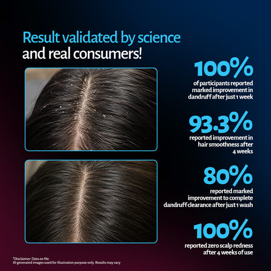Anti dandruff shampoo results: 100% saw marked improvement in 1 week, zero scalp redness by week 4