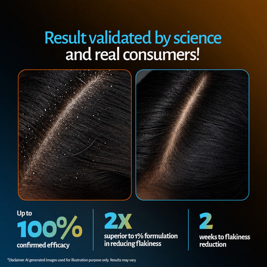 Ketoconazole shampoo results: 2x better than 1% formulas, less flaking in 2 weeks