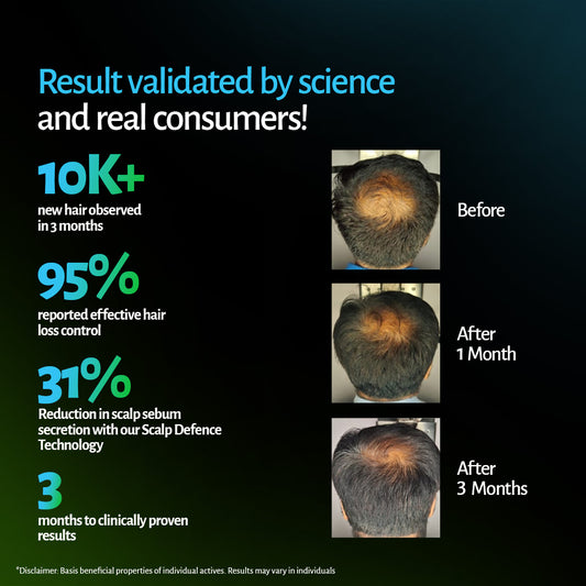 Hair regrowth serum results: 10,000+ new hairs in 3 months, 95% reported hair loss control